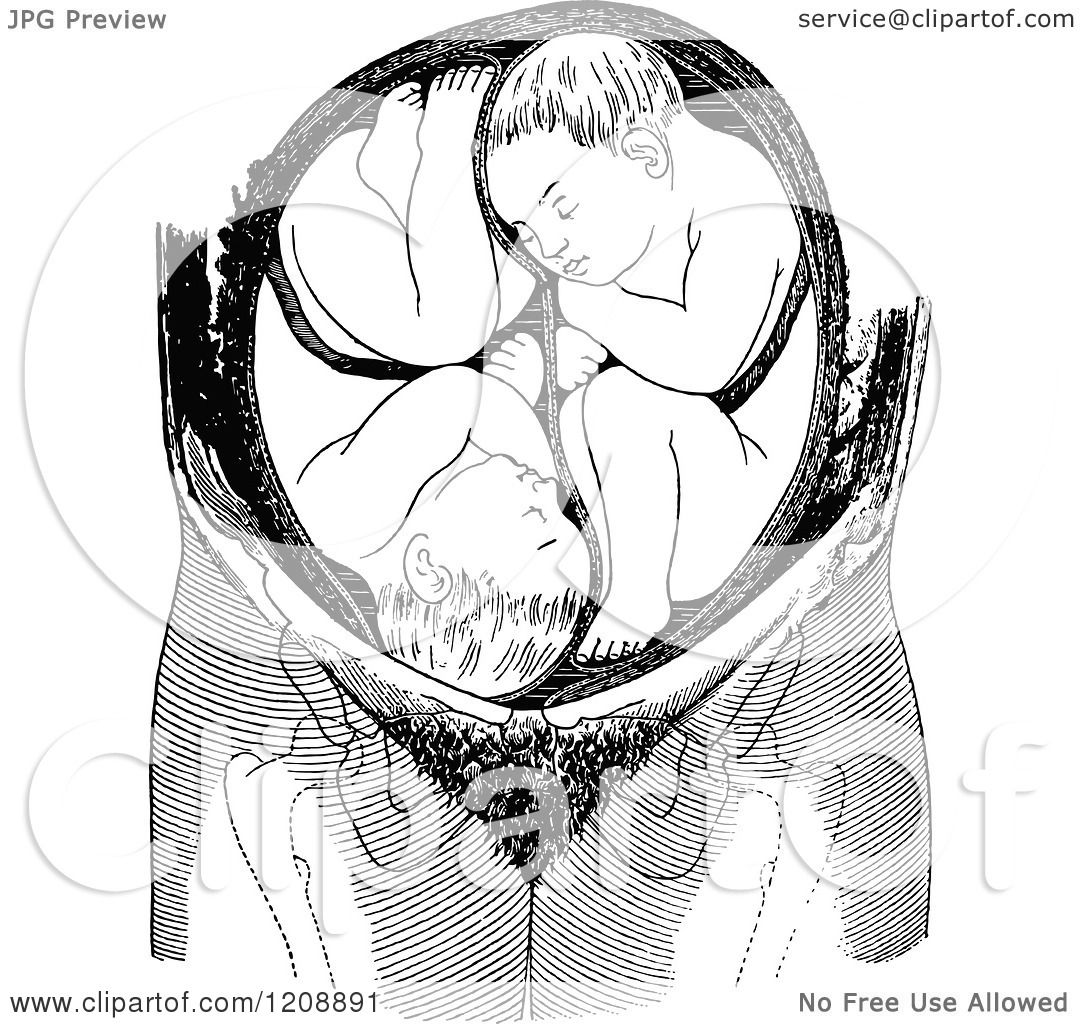Clipart of a Vintage Black and White Uterus with Twins - Royalty Free