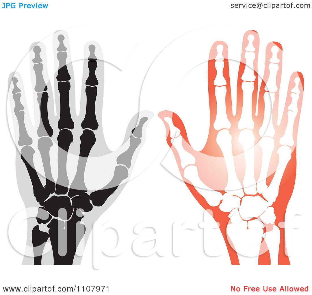 hand x ray clipart - photo #46