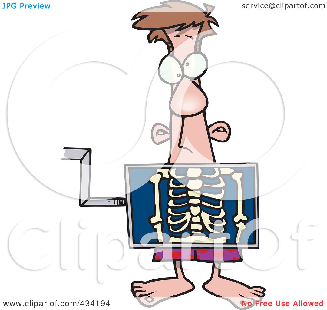 clipart of x ray - photo #24