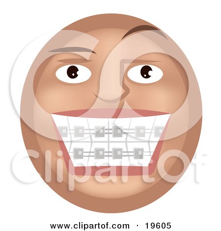 Clipart Illustration of a Metal Mouth Tan Smiley Face Showing Its Braces On 