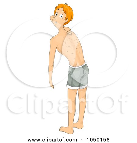 Royalty-Free (RF) Clip Art Illustration of a Young Man With A Skin Allergy by BNP Design Studio