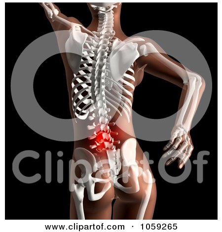 Royalty-Free CGI Clip Art Illustration of a 3d Female Skeleton With Highlighted Lower Spinal Back Pain by KJ Pargeter