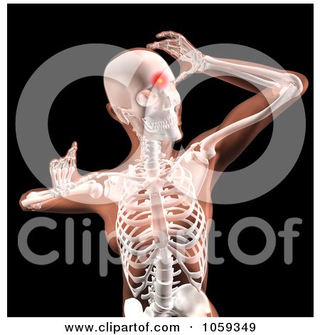 Royalty-Free CGI Clip Art Illustration of a 3d Woman's Body, With Head Pain Highlighted by KJ Pargeter