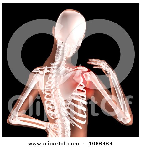 Clipart Medical 3d Female Skeleton With Highlighted Shoulder Pain - Royalty Free CGI Illustration by KJ Pargeter