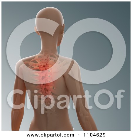 Clipart 3d Glowing Spinal Injury - Royalty Free CGI Illustration by Mopic