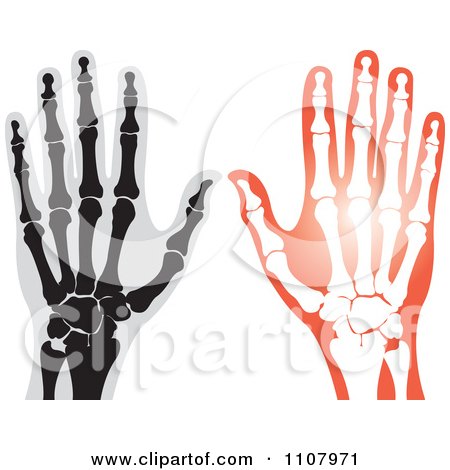 Clipart Xrays Of Human Hands 1 - Royalty Free Vector Illustration by Lal Perera