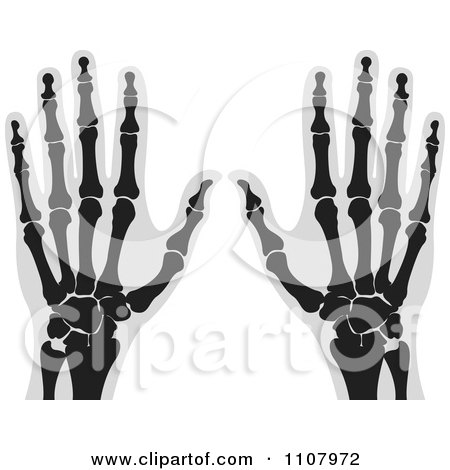 Clipart Xrays Of Human Hands 2 - Royalty Free Vector Illustration by Lal Perera