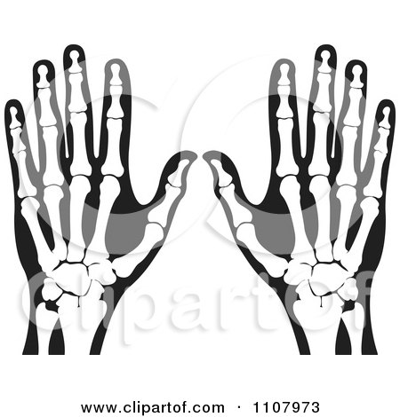 Clipart Xrays Of Human Hands 3 - Royalty Free Vector Illustration by Lal Perera