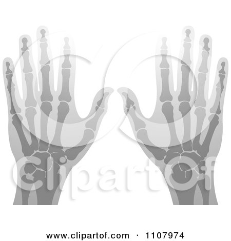 Clipart Xrays Of Human Hands 4 - Royalty Free Vector Illustration by Lal Perera