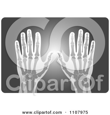 Clipart Xray Of Human Hands - Royalty Free Vector Illustration by Lal Perera