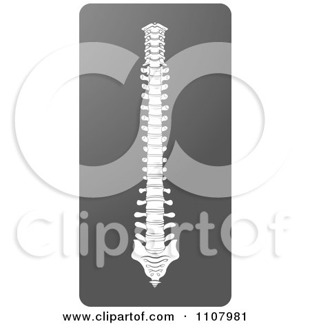 Clipart Human Spine X Ray - Royalty Free Vector Illustration by Lal Perera