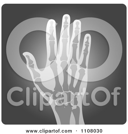 Clipart Human Hand Xray - Royalty Free Vector Illustration by Lal Perera