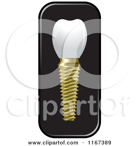 Clipart of a Dental Tooth Implant 2 - Royalty Free Vector Illustration by Lal Perera