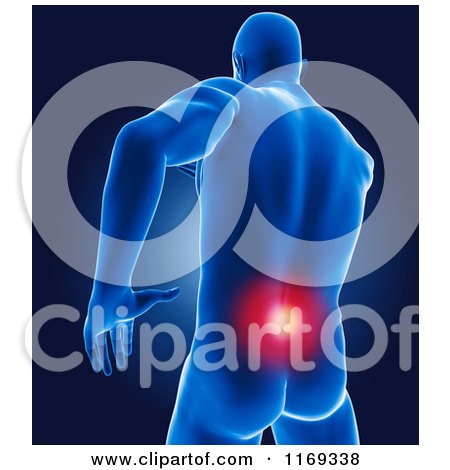 Clipart of a 3d Blue Man with Highlighted Back Pain - Royalty Free CGI Illustration by KJ Pargeter