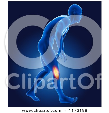 Clipart of a 3d Xray Man with Glowing Knee Joint Pain - Royalty Free CGI Illustration by KJ Pargeter