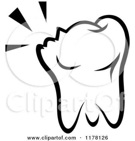 Clipart of a Black and White Chipped Molar Tooth - Royalty Free Vector Illustration by Vector Tradition SM