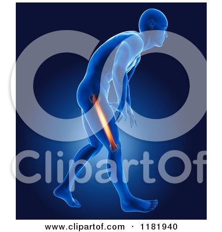 Clipart of a 3d Xray Man with Glowing Thigh Pain - Royalty Free CGI Illustration by KJ Pargeter