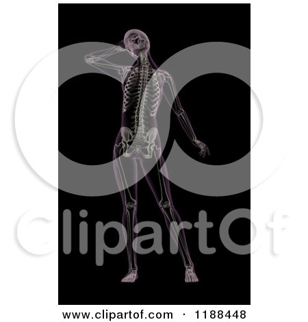 Clipart of a 3d Female Xray with Visible Skeleton and Migraine, on Black - Royalty Free CGI Illustration by KJ Pargeter