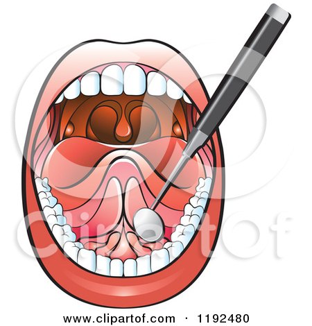 Clipart of a Dental Mirror Tool in an Open Mouth - Royalty Free Vector Illustration by Lal Perera