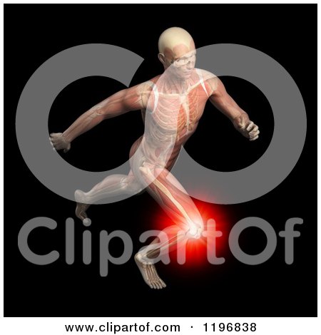 Clipart of a 3d Male Runner Body with Visible Knee Pain Muscles and Skeleton over Black - Royalty Free CGI Illustration by Mopic