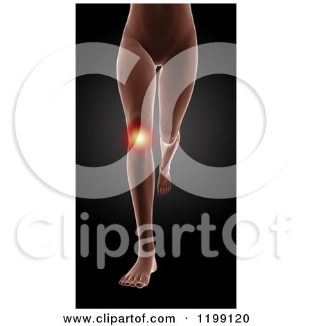 Clipart of a 3d Running Female Medical Model with Glowing Knee Pain over Black - Royalty Free CGI Illustration by KJ Pargeter