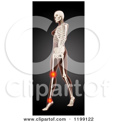 Clipart of a 3d Walking Female Medical Model with Glowing Knee and Ankle Pain on Black - Royalty Free CGI Illustration by KJ Pargeter