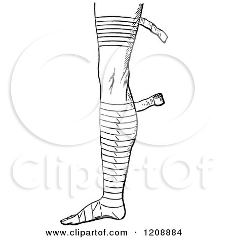 Clipart of a Vintage Black and White Bandaged Foot and Leg 2 - Royalty Free Vector Illustration by Prawny Vintage