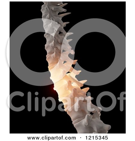 Clipart of a 3d Human Spine with Glowing Pain, on Black - Royalty Free Illustration by Mopic