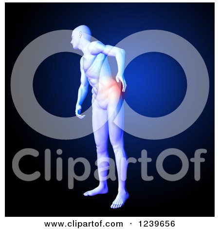 Clipart of a 3d Medical Man Model with Red Back Pain, over Blue 2 - Royalty Free CGI Illustration by KJ Pargeter