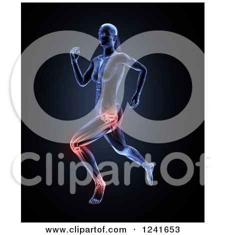Clipart of a 3d Female Runner with Highlighted Joint Pain - Royalty Free Illustration by Mopic