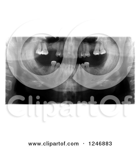 Clipart of a Dental Xray - Royalty Free Illustration by Vector Tradition SM