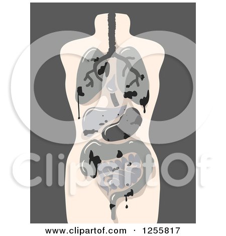 Clipart of a Model of Damaged Human Organs - Royalty Free Vector Illustration by BNP Design Studio