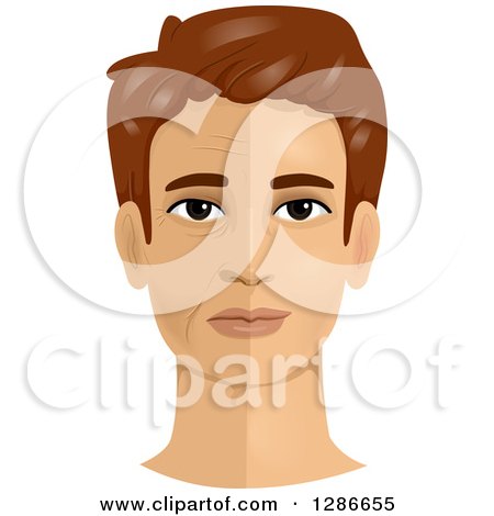 Clipart of a Brunette White Man's Face Shown Pre and Post a Face Lift Cosmetic Plastic Surgery - Royalty Free Vector Illustration by BNP Design Studio