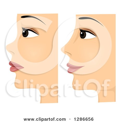 Clipart of a Composite of Profiled Before and After on a Woman with Rhinoplasty Nose Surgery - Royalty Free Vector Illustration by BNP Design Studio
