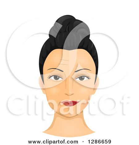 Clipart of a Pre and Post View of a Woman's Face Showing Cosmetic Surgery - Royalty Free Vector Illustration by BNP Design Studio
