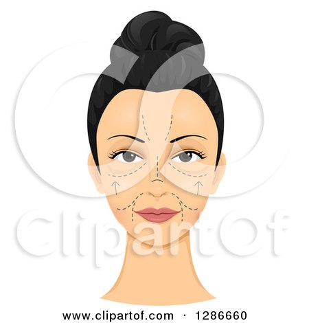 Clipart of a Woman's Face Shown with Pre-surgical Cosmetic Incision Marks - Royalty Free Vector Illustration by BNP Design Studio