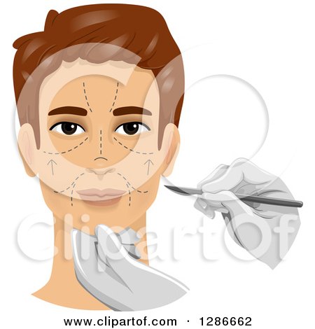 Clipart of a Brunette White Man with Marks on His Face and a Surgeon Holding a Scalpel for Cosmetic Plastic Surgery - Royalty Free Vector Illustration by BNP Design Studio
