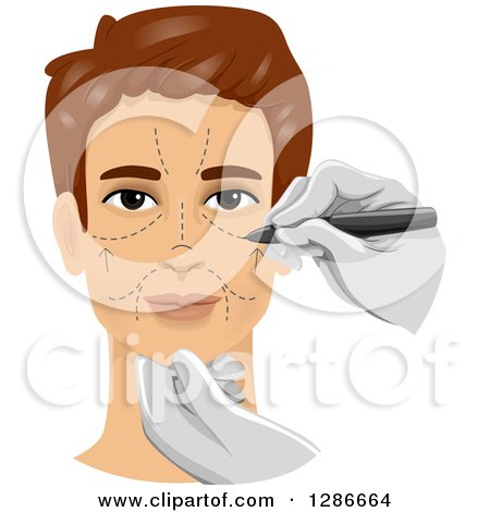Clipart of a Brunette White Man Getting Marks on His Face in Preparation of Cosmetic Plastic Surgery - Royalty Free Vector Illustration by BNP Design Studio