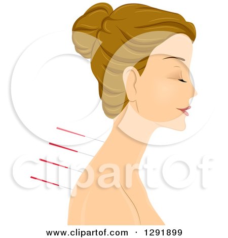 Clipart of a Relaxed Caucasian Woman with Acupuncture Needles in Profile - Royalty Free Vector Illustration by BNP Design Studio