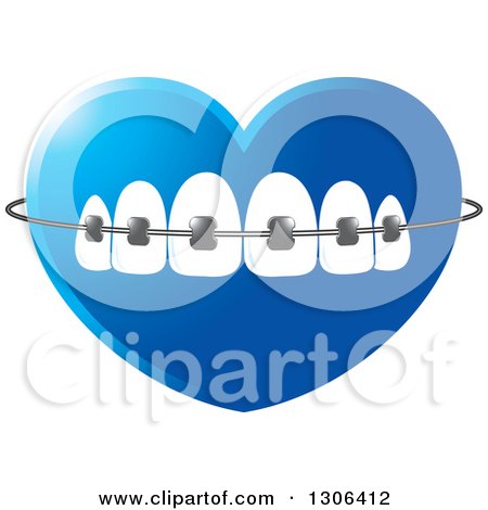 Clipart of a Gradient Blue Heart with Teeth and Dental Braces - Royalty Free Vector Illustration by Lal Perera