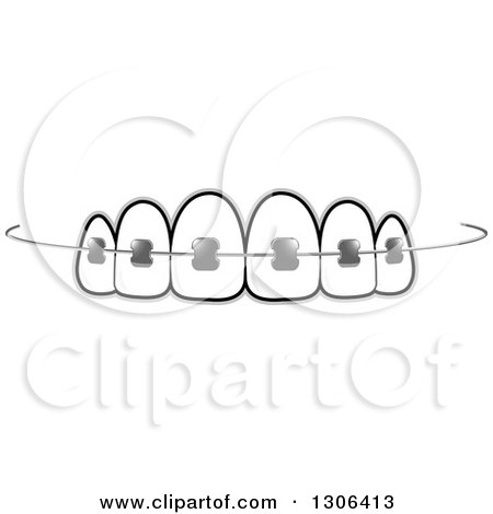 Clipart of Teeth and Dental Braces - Royalty Free Vector Illustration by Lal Perera