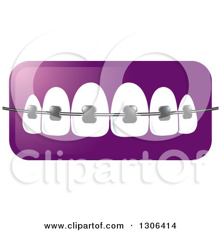 Clipart of a Gradient Purple Icon of Teeth and Dental Braces - Royalty Free Vector Illustration by Lal Perera