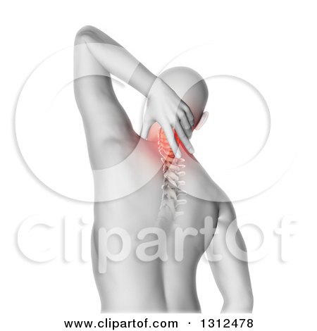 Clipart of a 3d Rear View of a Medical Anatomical Male Reaching Back, with Visible Neck Vertebrae Pain on White - Royalty Free Illustration by KJ Pargeter