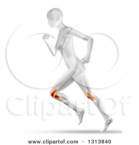 Clipart of a 3d Anatomical Woman Running, with Visible Knee Joint Pain and Leg Bones, on White - Royalty Free Illustration by KJ Pargeter