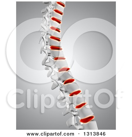 Clipart of a 3d Human Spine with Red Discs Highlighted over Gray - Royalty Free Illustration by KJ Pargeter