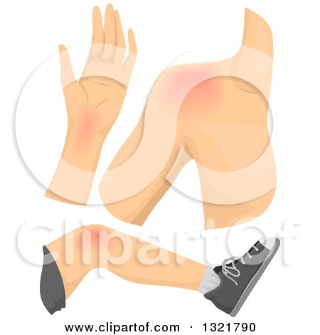 Clipart of White Male Body Parts Showing Pain - Royalty Free Vector Illustration by BNP Design Studio