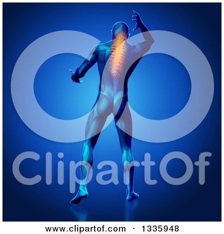 Clipart of a 3d Rear View of a Medical Anatomical Male Reaching Back, with Visible Flaming Neck Vertebrae Pain and Muscles, on Blue - Royalty Free Illustration by KJ Pargeter