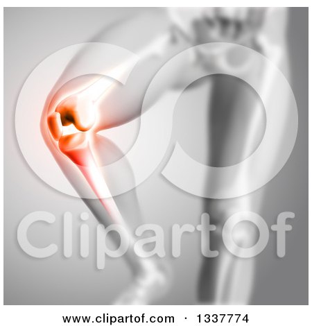 Clipart of a 3d Anatomical Human Male Skeleton with Red Glowing Knee Pain, on Gray - Royalty Free Illustration by KJ Pargeter