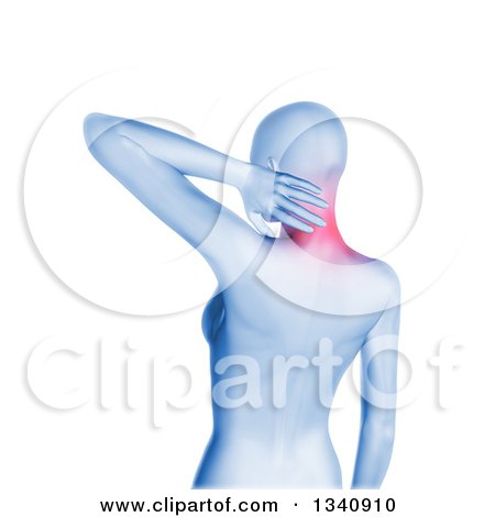 Clipart of a 3d Blue Anatomical Woman with Glowing Neck Pain, over White - Royalty Free Illustration by KJ Pargeter