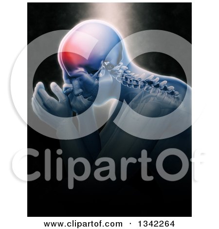 Clipart of a 3d Xray Anatomical Man with Visible Spine and Head Pain, over Black with Light Shining down - Royalty Free Illustration by KJ Pargeter